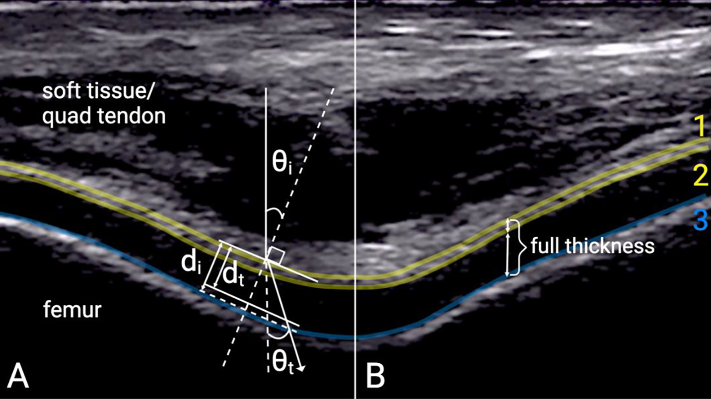 Ultrasound Assessments